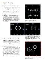 Preview for 27 page of Smith & Nephew JOURNEY II BCS Manual