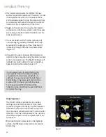 Preview for 28 page of Smith & Nephew JOURNEY II BCS Manual