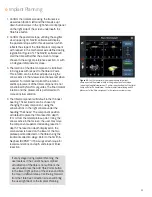 Preview for 29 page of Smith & Nephew JOURNEY II BCS Manual