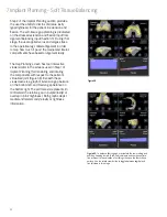 Preview for 32 page of Smith & Nephew JOURNEY II BCS Manual