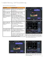 Preview for 35 page of Smith & Nephew JOURNEY II BCS Manual