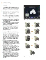 Preview for 41 page of Smith & Nephew JOURNEY II BCS Manual