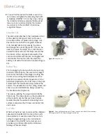 Preview for 42 page of Smith & Nephew JOURNEY II BCS Manual