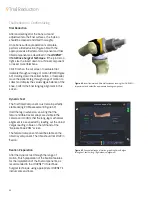 Preview for 44 page of Smith & Nephew JOURNEY II BCS Manual