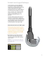 Preview for 17 page of smith&nephew LEGION Cones Surgical Technique