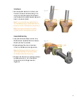 Preview for 19 page of smith&nephew LEGION Cones Surgical Technique