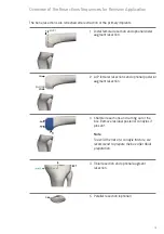 Preview for 17 page of smith&nephew RT-PLUS Surgical Technique