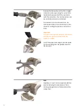 Preview for 28 page of smith&nephew RT-PLUS Surgical Technique