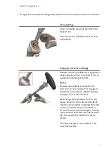 Preview for 33 page of smith&nephew RT-PLUS Surgical Technique