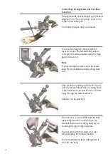 Preview for 36 page of smith&nephew RT-PLUS Surgical Technique