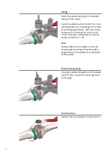 Preview for 44 page of smith&nephew RT-PLUS Surgical Technique