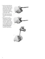 Preview for 16 page of smith&nephew ZUK Surgical Techniques