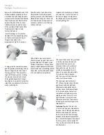 Preview for 20 page of smith&nephew ZUK Surgical Techniques