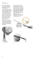 Preview for 42 page of smith&nephew ZUK Surgical Techniques