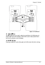 Предварительный просмотр 27 страницы Smiths Medical 1850 Operation Manual