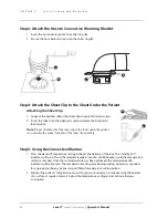 Preview for 20 page of Smiths Medical L1-CW-100V Operator'S Manual