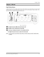 Preview for 31 page of Smiths Medical SurgiVet V3404 Plus Operation Manual