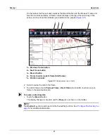 Предварительный просмотр 36 страницы Snap-On SOLUS Ultra User Manual