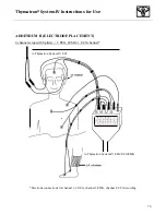 Preview for 71 page of Somatics Thymatron System IV User Manual