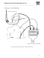 Preview for 75 page of Somatics Thymatron System IV User Manual