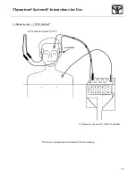 Preview for 76 page of Somatics Thymatron System IV User Manual