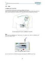 Preview for 36 page of SOMNOmedics SOMNOscreen plus Instruction Manual