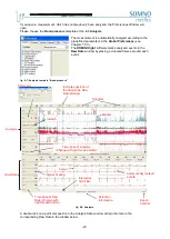 Preview for 27 page of SOMNOmedics SOMNOwatch plus BP Instruction Manual