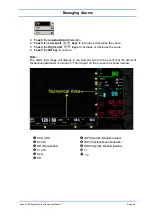 Preview for 56 page of Spacelabs Healthcare 93300 Operation Manual