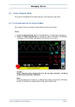 Preview for 59 page of Spacelabs Healthcare 93300 Operation Manual