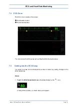 Preview for 80 page of Spacelabs Healthcare 93300 Operation Manual