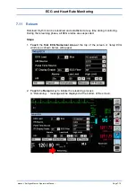 Preview for 86 page of Spacelabs Healthcare 93300 Operation Manual