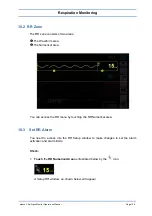 Preview for 97 page of Spacelabs Healthcare 93300 Operation Manual