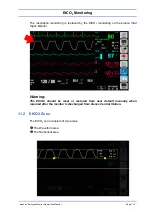 Preview for 101 page of Spacelabs Healthcare 93300 Operation Manual