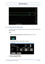 Preview for 110 page of Spacelabs Healthcare 93300 Operation Manual