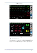 Preview for 113 page of Spacelabs Healthcare 93300 Operation Manual