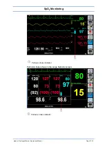 Preview for 117 page of Spacelabs Healthcare 93300 Operation Manual