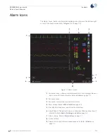 Предварительный просмотр 73 страницы Spacelabs 91390 Operation Manual