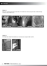 Предварительный просмотр 6 страницы Sport-thieme Jump Assembly And Use Instruction