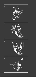 Preview for 3 page of Sporto medix FastProtect Malleo Instructions For Use Manual