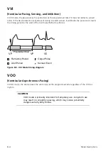 Предварительный просмотр 42 страницы St. Jude Medical Merlin PSA EX3100 Help Manual