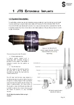 Предварительный просмотр 5 страницы STANMORE IMPLANTS JTS MLE3 Operation Manual