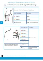 Предварительный просмотр 26 страницы Steeper Espire Elbow Pro & Hybrid Instruction Manual