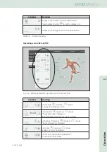 Предварительный просмотр 55 страницы Storz DUOLITH SD1 R-SW Operating Manual