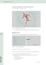 Предварительный просмотр 64 страницы Storz DUOLITH SD1 R-SW Operating Manual