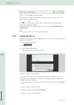 Предварительный просмотр 66 страницы Storz DUOLITH SD1 R-SW Operating Manual