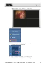 Предварительный просмотр 50 страницы Storz OR1 FUSION WO300 Instructions For Use Manual