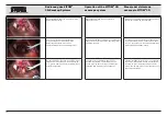 Preview for 35 page of Storz TC 014 Instruction Manual