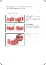 Предварительный просмотр 4 страницы Straumann Novaloc Technical Information