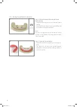 Preview for 6 page of Straumann Novaloc Technical Information