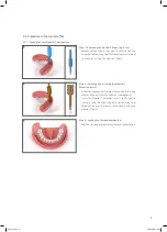 Preview for 7 page of Straumann Novaloc Technical Information